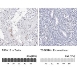 TSSK1 Antibody, Novus Biologicals 0.1mL; Unlabeled:Antibodies, Polyclonal