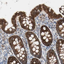 TST Antibody, Novus Biologicals:Antibodies:Primary Antibodies