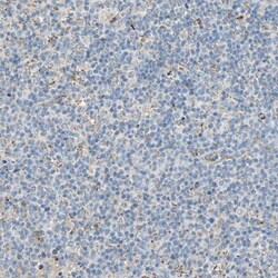 TST Antibody, Novus Biologicals:Antibodies:Primary Antibodies