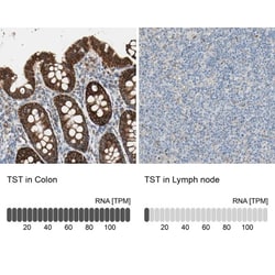 TST Antibody, Novus Biologicals:Antibodies:Primary Antibodies