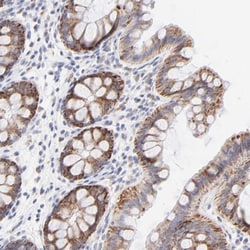 TST Antibody, Novus Biologicals 0.1mL; Unlabeled:Antibodies, Polyclonal