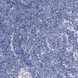 TST Antibody, Novus Biologicals 0.1mL; Unlabeled:Antibodies, Polyclonal