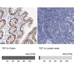 TST Antibody, Novus Biologicals 0.1mL; Unlabeled:Antibodies, Polyclonal