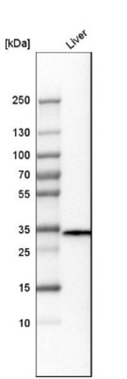 TST Antibody, Novus Biologicals 0.1mL; Unlabeled:Antibodies, Polyclonal