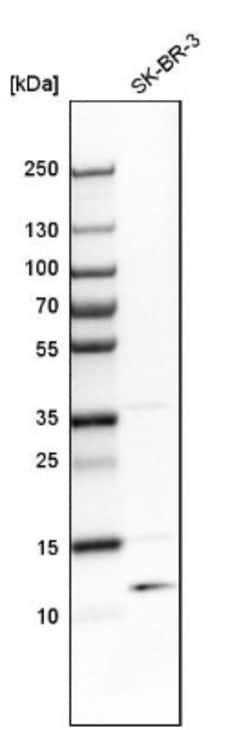 TSTD1 Antibody, Novus Biologicals 25 &mu;L | Buy Online | Novus Biologicals | Fisher Scientific