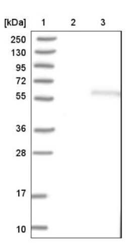 PBX1 Antibody, Novus Biologicals:Antibodies:Primary Antibodies