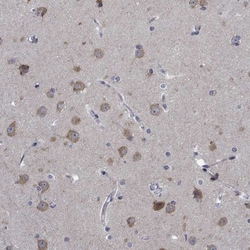 TTBK1 Antibody, Novus Biologicals:Antibodies:Primary Antibodies