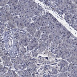 TTBK1 Antibody, Novus Biologicals:Antibodies:Primary Antibodies