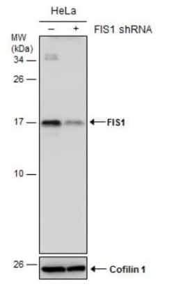 TTC11 Antibody (4211), Novus Biologicals 0.1mL; Unlabeled:Antibodies, Monoclonal