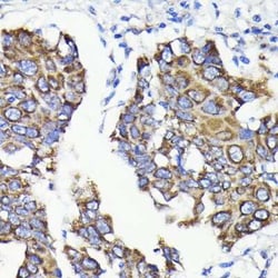 TTC11 Rabbit anti-Human, Mouse, Rat, Clone: 6S1G4, Novus Biologicals:Antibodies:Primary