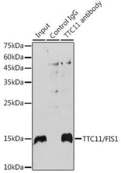 TTC11 Rabbit anti-Human, Mouse, Rat, Clone: 6S1G4, Novus Biologicals:Antibodies:Primary