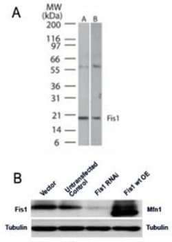 TTC11 Antibody, Novus Biologicals 0.2mL; Unlabeled:Antibodies, Polyclonal