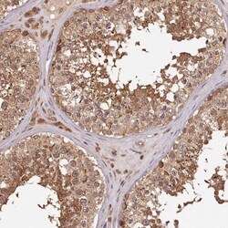 TTC12 Antibody, Novus Biologicals:Antibodies:Primary Antibodies