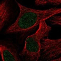 TTC15 Rabbit anti-Human, Polyclonal, Novus Biologicals 100 &mu;g | Buy Online | Novus Biologicals | Fisher Scientific