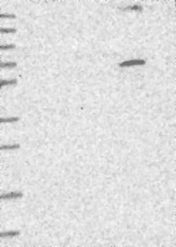 TTC15 Rabbit anti-Human, Polyclonal, Novus Biologicals 100 &mu;g | Buy Online | Novus Biologicals | Fisher Scientific
