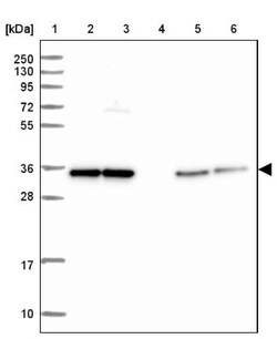TTC19 Antibody, Novus Biologicals:Antibodies:Primary Antibodies