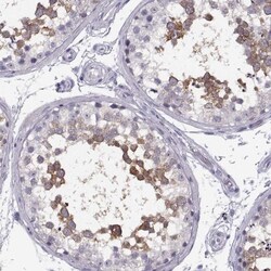 TTC21A Antibody, Novus Biologicals 0.1mL; Unlabeled:Antibodies, Polyclonal