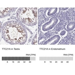 TTC21A Antibody, Novus Biologicals 0.1mL; Unlabeled:Antibodies, Polyclonal