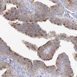 TTC21B Antibody, Novus Biologicals 25 &mu;L; Unlabeled:Antibodies, Polyclonal