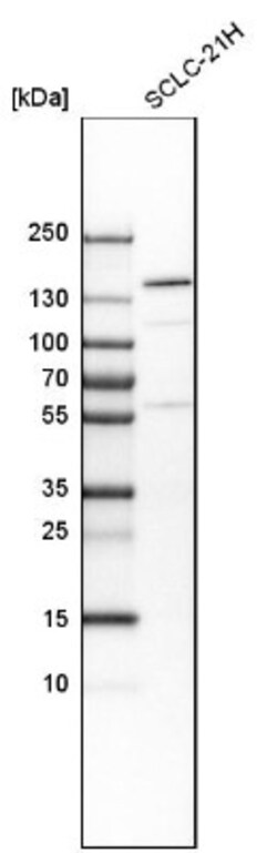 TTC21B Antibody, Novus Biologicals 25 &mu;L; Unlabeled:Antibodies, Polyclonal