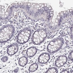 TTC26 Antibody, Novus Biologicals:Antibodies:Primary Antibodies