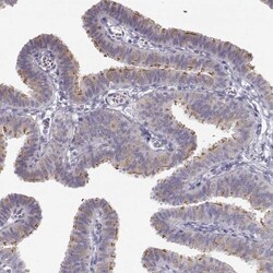 TTC26 Antibody, Novus Biologicals:Antibodies:Primary Antibodies