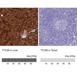 TTC36 Antibody, Novus Biologicals 25 &mu;L | Buy Online | Novus Biologicals | Fisher Scientific
