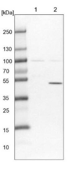 TTC38 Antibody, Novus Biologicals:Antibodies:Primary Antibodies