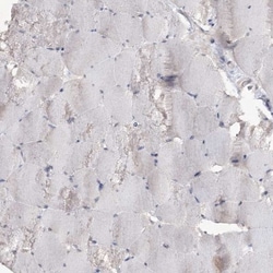 TTC7A Antibody, Novus Biologicals:Antibodies:Primary Antibodies
