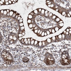 TTC7A Antibody, Novus Biologicals:Antibodies:Primary Antibodies