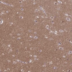 TTC7B Antibody, Novus Biologicals:Antibodies:Primary Antibodies