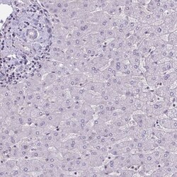 TTC7B Antibody, Novus Biologicals:Antibodies:Primary Antibodies