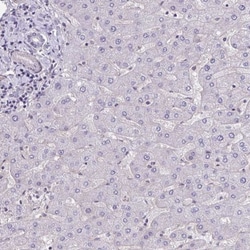 TTC7B Antibody, Novus Biologicals 0.1mL; Unlabeled:Antibodies, Polyclonal