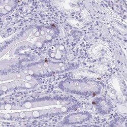 TTDN1 Antibody, Novus Biologicals:Antibodies:Primary Antibodies