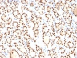 TTF-1/ NKX2-1 Antibody (8G7G3/1), Novus Biologicals 0.2mg; Unlabeled:Antibodies,