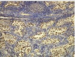 Rabbit anti-TTF1 / NKX2.1, Clone: G21-G, Novus Biologicals 100&mu;L; Unlabeled:Antibodies,