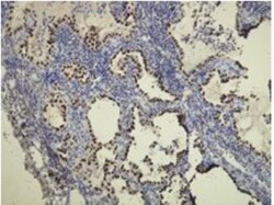 Rabbit anti-TTF1 / NKX2.1, Clone: G21-G, Novus Biologicals 100&mu;L; Unlabeled:Antibodies,