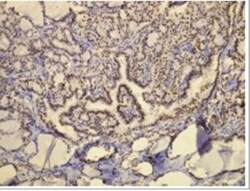 Rabbit anti-TTF1 / NKX2.1, Clone: G21-G, Novus Biologicals 100&mu;L; Unlabeled:Antibodies,