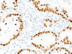 TTF-1/ NKX2-1 Antibody (NX2.1/690), Novus Biologicals 0.2mg; Unlabeled:Antibodies,