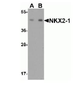 TTF-1/ NKX2-1 Antibody - BSA Free, Novus Biologicals 0.025 mg, Unlabeled:Antibodies,