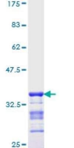 Novus Biologicals Recombinant Human TTF-1/ NKX2-1 GST (N-Term) Protein 10 &mu;g | Buy Online | Novus Biologicals&trade; | Fisher Scientific