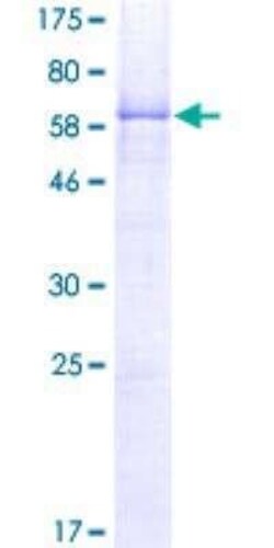 Novus Biologicals Recombinant Human TTF-1/ NKX2-1 GST (N-Term) Protein 2 &mu;g | Buy Online | Novus Biologicals&trade; | Fisher Scientific