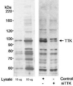 TTK Antibody, Novus Biologicals 0.1mg; Unlabeled:Antibodies, Polyclonal