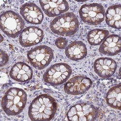 TTLL11 Antibody, Novus Biologicals:Antibodies:Primary Antibodies