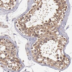 TTLL12 Antibody, Novus Biologicals 0.1mL; Unlabeled:Antibodies, Polyclonal
