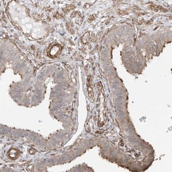 TTLL5 Antibody, Novus Biologicals:Antibodies:Primary Antibodies