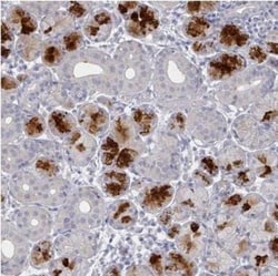 TTYH3 Antibody, Novus Biologicals 25 &mu;L, Unlabeled:Antibodies, Polyclonal
