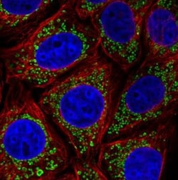 TUFM Antibody (CL2242), Novus Biologicals 0.1mL; Unlabeled:Antibodies,
