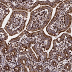 TUFM Antibody (CL2242), Novus Biologicals 0.1mL; Unlabeled:Antibodies,