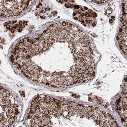 TUFM Antibody (CL2242), Novus Biologicals 0.1mL; Unlabeled:Antibodies,